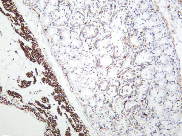 m04578 2 cald1 primary antibodies ihc testing 3