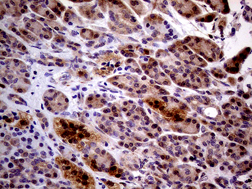 Immunohistochemical staining of paraffin-embedded Human pancreas tissue within the normal limits using anti-PCMT1 mouse monoclonal antibody