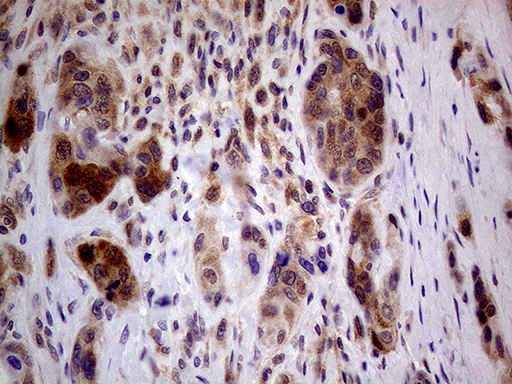 m04579 anti pcmt1 mouse monoclonal antibody clone id oti2a9 ihc testing 4