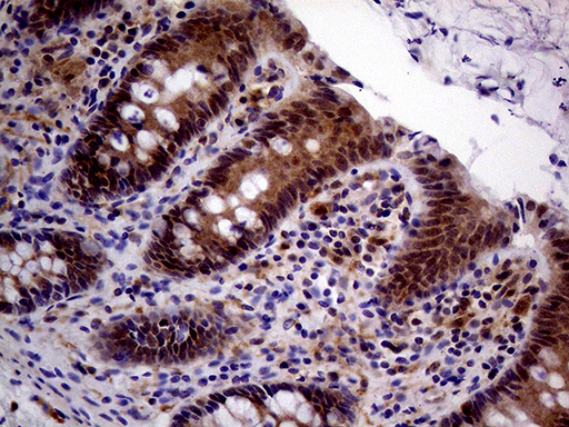 m04579 anti pcmt1 mouse monoclonal antibody clone id oti2a9 ihc testing 5