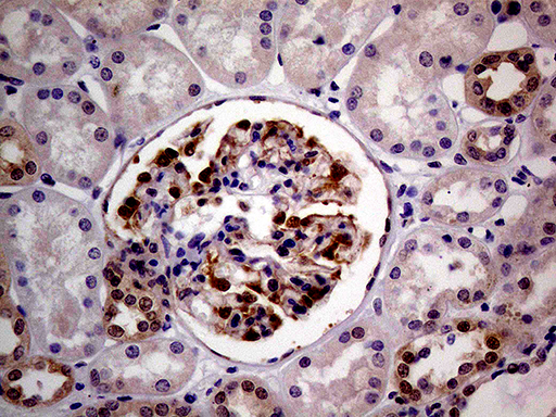 m04579 anti pcmt1 mouse monoclonal antibody clone id oti2a9 ihc testing 6