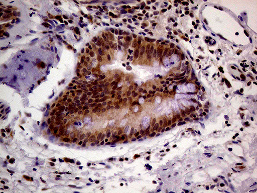 m04579 anti pcmt1 mouse monoclonal antibody clone id oti2a9 ihc testing 7