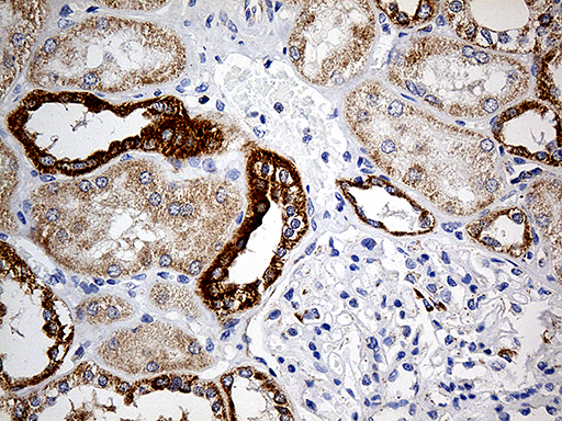 m04584 anti cox17 mouse monoclonal antibody clone id oti7h5 ihc testing 5