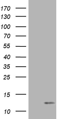 HEK293T cells were transfected with the pCMV6-ENTRY control (Left lane) or pCMV6-ENTRY COX17 (Right lane) cDNA for 48 hrs and lysed