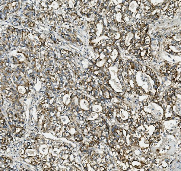 m04586 1 txn2 primary antibodies ihc testing 4
