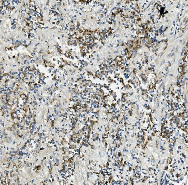 m04586 1 txn2 primary antibodies ihc testing 5