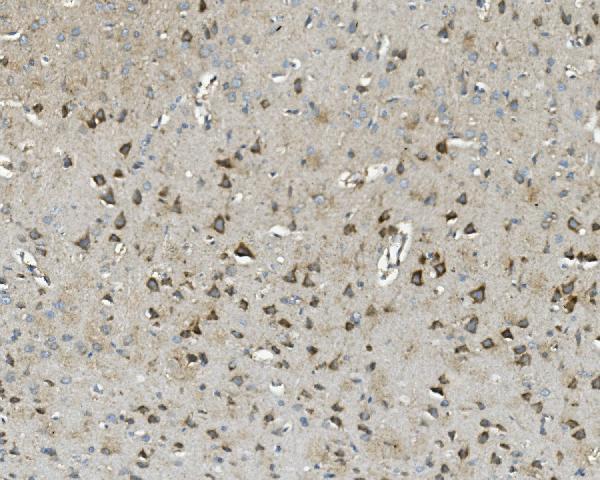 m04586 1 txn2 primary antibodies ihc testing 6