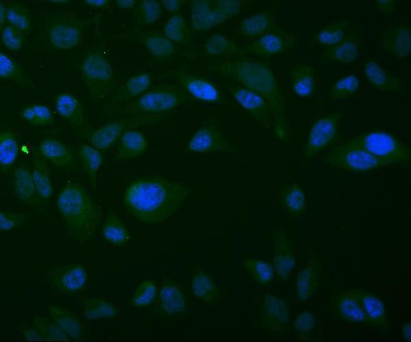 m04586 2 txn2 primary antibodies if testing 2