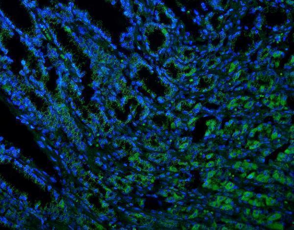 m04586 2 txn2 primary antibodies if testing 3