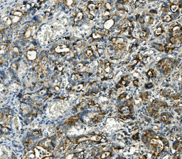 m04586 2 txn2 primary antibodies ihc testing 6