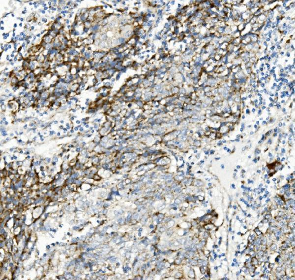 m04586 2 txn2 primary antibodies ihc testing 7