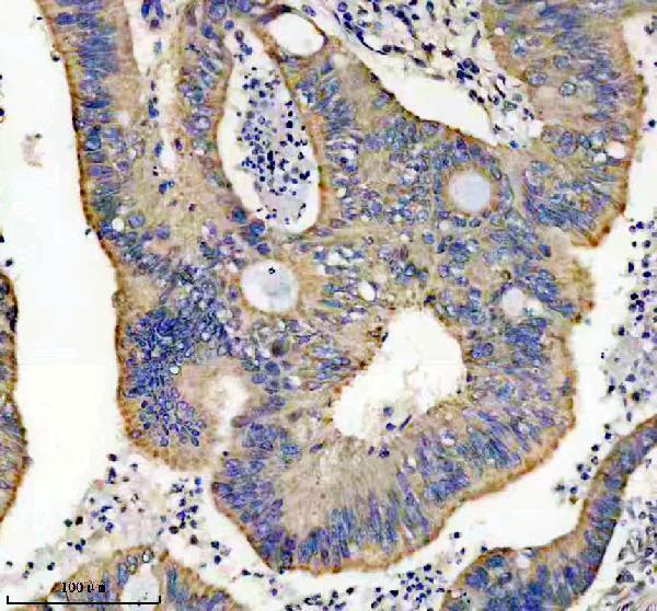 IHC analysis of TRX2 using anti-TRX2 antibody (M04586)