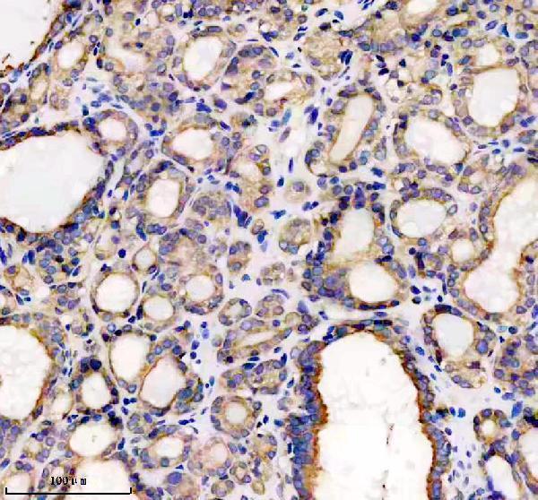 IHC analysis of TRX2 using anti-TRX2 antibody (M04586)