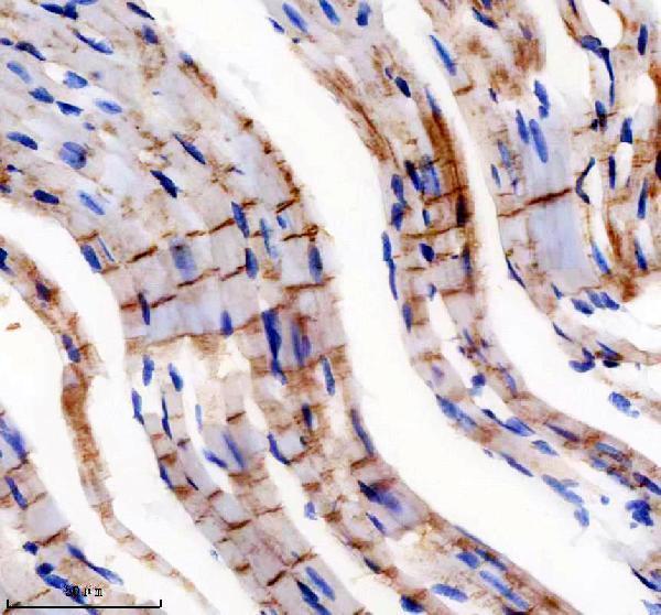 IHC analysis of TRX2 using anti-TRX2 antibody (M04586)