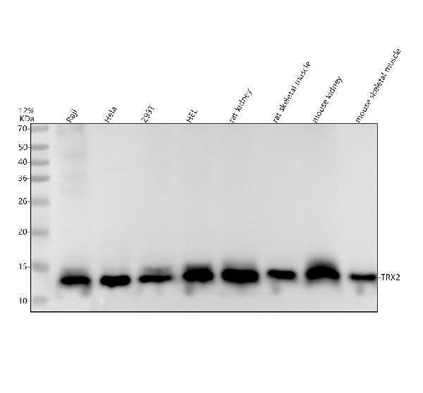 m04586 trx2 primary antibodies wb testing 1