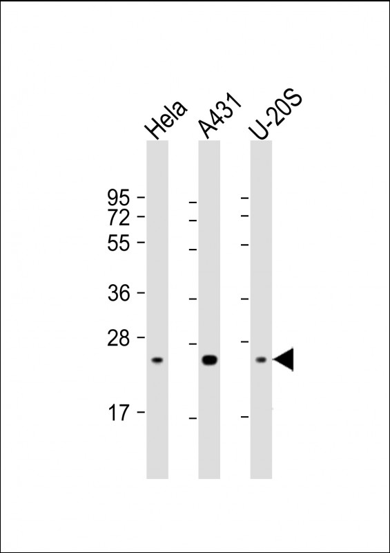 All lanes : Anti-RAB1B Antibody at 1:4000 dilution Lane 1: Hela whole cell lysate Lane 2: A431 whole cell lysate Lane 3: U-20S whole cell lysate Lysates/proteins at 20 microg per lane. Secondary Goat Anti-mouse IgG, (H+L), Peroxidase conjugated at 1/10000 dilution. Predicted band size : 22 kDa Blocking/Dilution buffer: 5% NFDM/TBST.