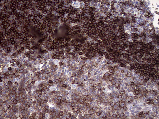Immunohistochemical staining of paraffin-embedded Human lymph node tissue within the normal limits using anti-RAB23 mouse monoclonal antibody