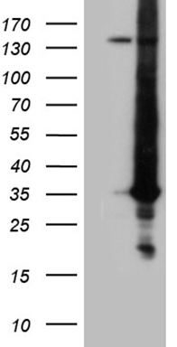 HEK293T cells were transfected with the pCMV6-ENTRY control (Left lane) or pCMV6-ENTRY RAB23 (Right lane) cDNA for 48 hrs and lysed