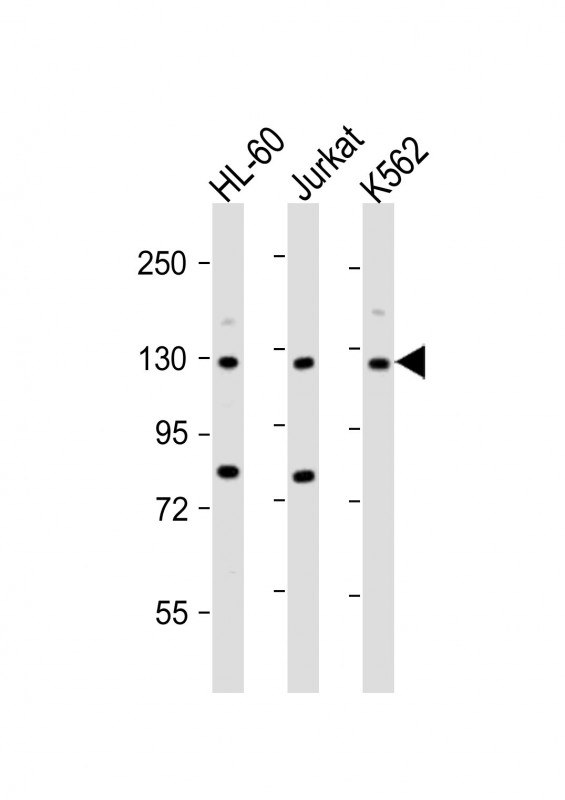 m04597 anti atp2a3 antibody n term wb testing 1