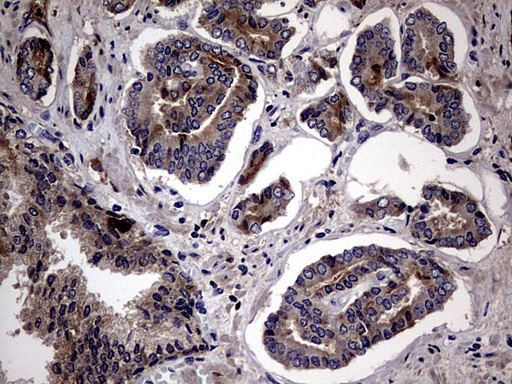 m04601 anti plod2 mouse monoclonal antibody clone id oti6d1 ihc testing 2