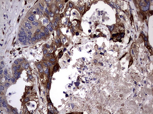 m04601 anti plod2 mouse monoclonal antibody clone id oti6d1 ihc testing 3