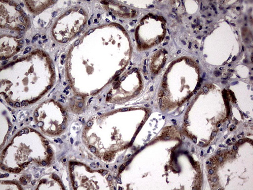 m04601 anti plod2 mouse monoclonal antibody clone id oti6d1 ihc testing 4