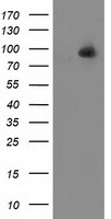 HEK293T cells were transfected with the pCMV6-ENTRY control (Left lane) or pCMV6-ENTRY ALDH1L1 (Right lane) cDNA for 48 hrs and lysed