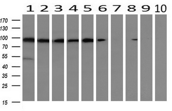 Western blot analysis of extracts (10ug) from 10 Human tissue by using anti-ALDH1L1 monoclonal antibody at 1:200 (1: Testis; 2: Omentum; 3: Uterus; 4: Breast; 5: Brain; 6: Liver; 7: Ovary; 8: Thyroid gland; 9: colon;10: spleen)