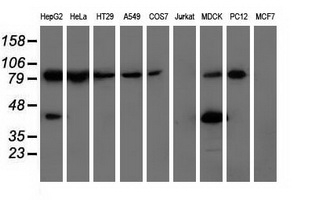 Western blot analysis of extracts (35ug) from 9 different cell lines by using anti-ALDH1L1 monoclonal antibody