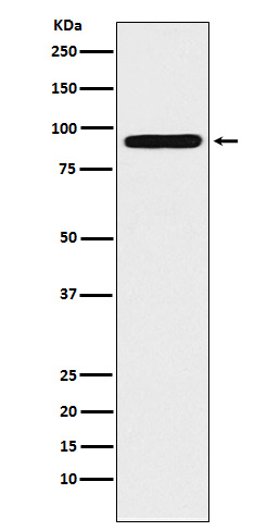 Western blot analysis of ALDH1L1 expression in 293T cell lysate