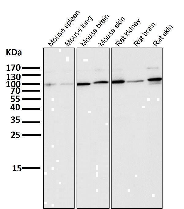 All lanes use the Antibody at 1:5K dilution for 1 hour at room temperature