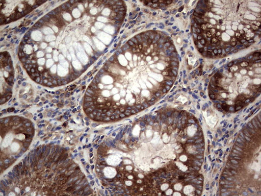 Immunohistochemical staining of paraffin-embedded Human colon tissue within the normal limits using anti-GARS mouse monoclonal antibody