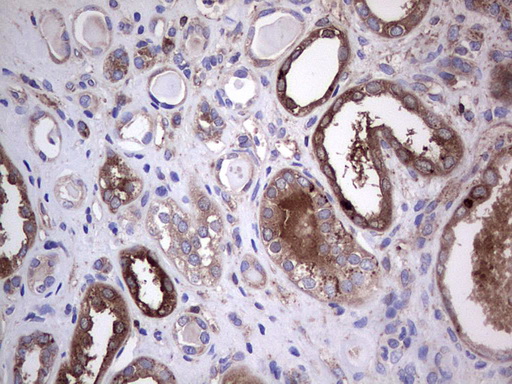 m04618 1 anti gars1 mouse monoclonal antibody clone id oti4g4 ihc testing 12
