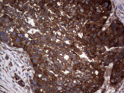m04618 1 anti gars1 mouse monoclonal antibody clone id oti4g4 ihc testing 13