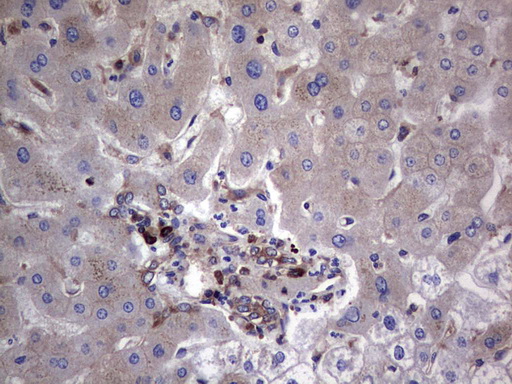 m04618 1 anti gars1 mouse monoclonal antibody clone id oti4g4 ihc testing 14