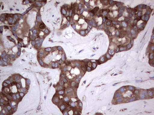 m04618 1 anti gars1 mouse monoclonal antibody clone id oti4g4 ihc testing 15