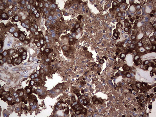 m04618 1 anti gars1 mouse monoclonal antibody clone id oti4g4 ihc testing 2