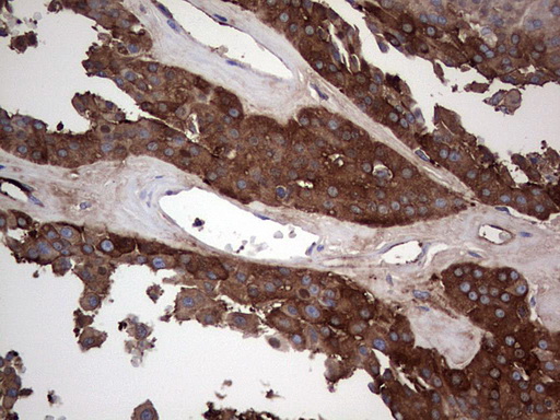 m04618 1 anti gars1 mouse monoclonal antibody clone id oti4g4 ihc testing 4