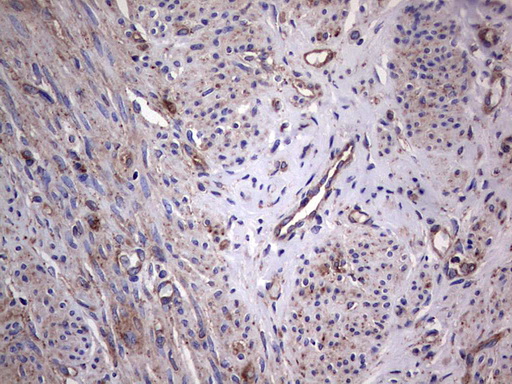 m04618 1 anti gars1 mouse monoclonal antibody clone id oti4g4 ihc testing 5