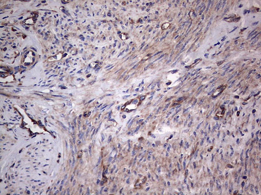 m04618 1 anti gars1 mouse monoclonal antibody clone id oti4g4 ihc testing 6