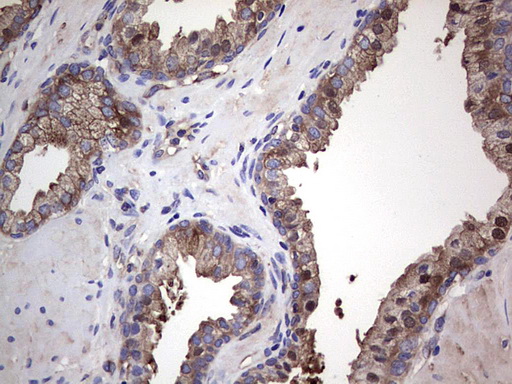 m04618 1 anti gars1 mouse monoclonal antibody clone id oti4g4 ihc testing 7