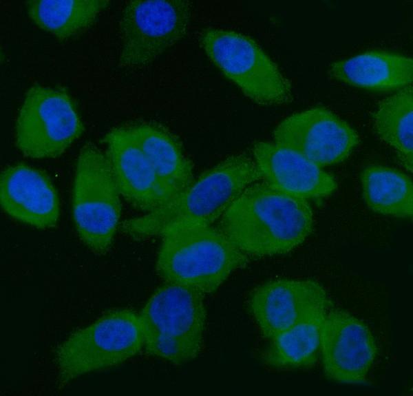  IF analysis of EIF5 using anti-EIF5 antibody (M04623)