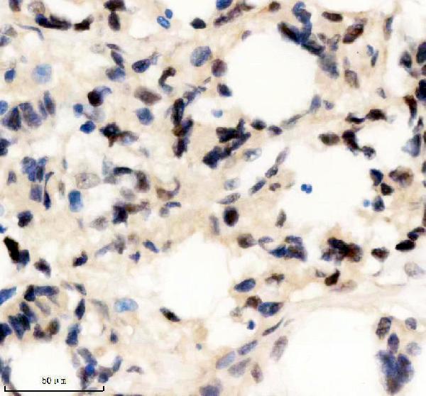 m04626 thoc1 primary antibodies ihc testing 1