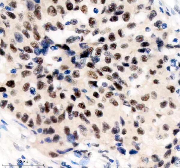 m04626 thoc1 primary antibodies ihc testing 2