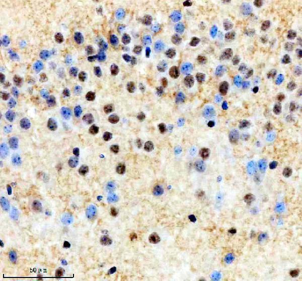 m04626 thoc1 primary antibodies ihc testing 3