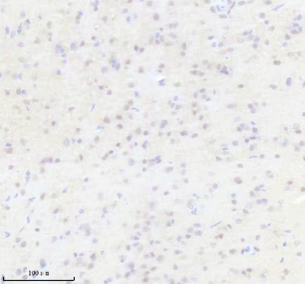 m04626 thoc1 primary antibodies ihc testing 4