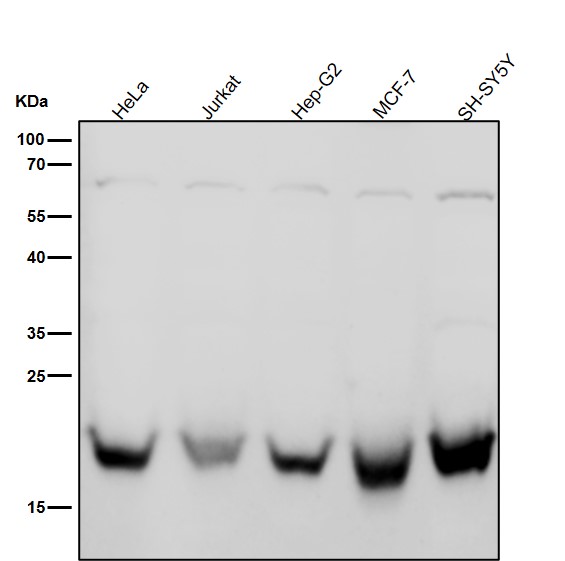 All lanes use the Antibody at 1:2K dilution for 1 hour at room temperature