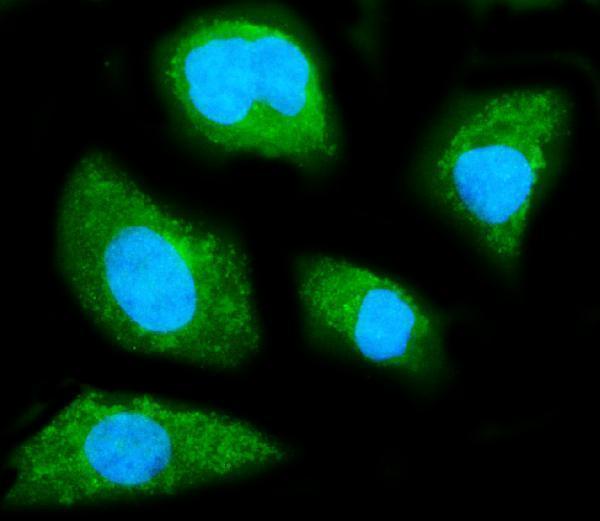  IF analysis of GNB1 using anti-GNB1 antibody (M04650)