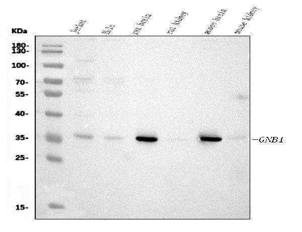  Western blot analysis of GNB1 using anti-GNB1 antibody (M04650)