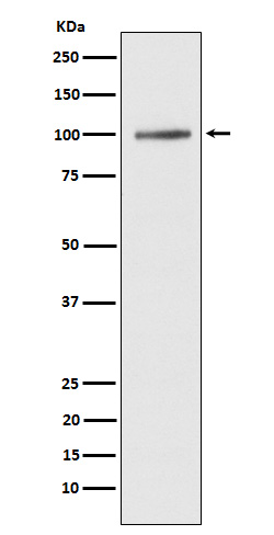 Western blot analysis of ATP2A1/SERCA1 expression in human fetal muscle lysate